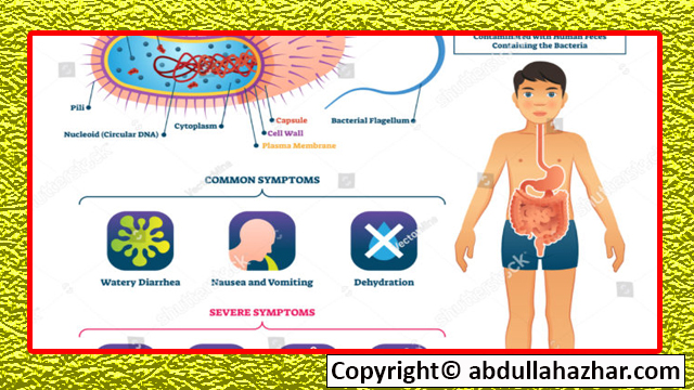 CHALORIA Diseases: Symptoms, Preventions, Treatment full in Detailed