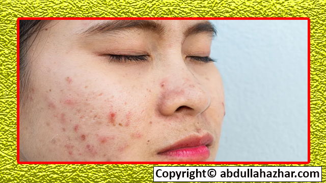 skin disease side effects and solution 2023